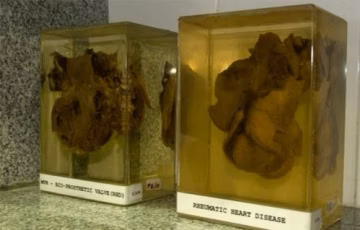 International Centre For Cardio-Thoracic and Vascular Diseases campus gallery